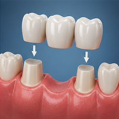 Serivce Image